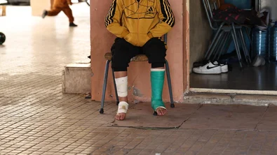 11-year old boy sits with broken foot at the collective shelter